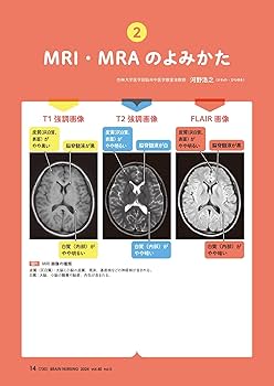 The Medical Interview 第5版 ブレインナーシング 2024年5号〈特集〉脳画像で読み解く脳神経